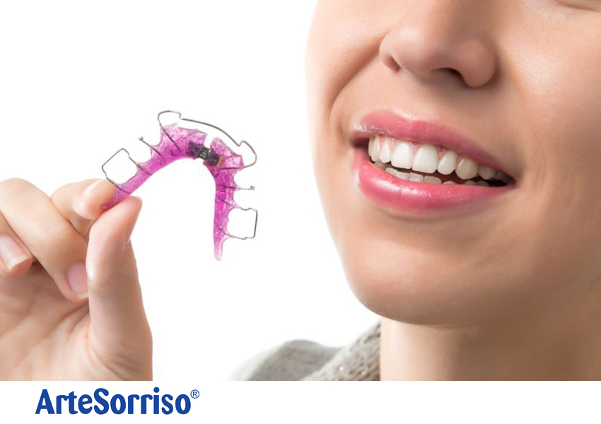 Featured image of post Porque Os Ingleses Tem Dentes Tortos O apinhamento dent rio por exemplo tem como uma